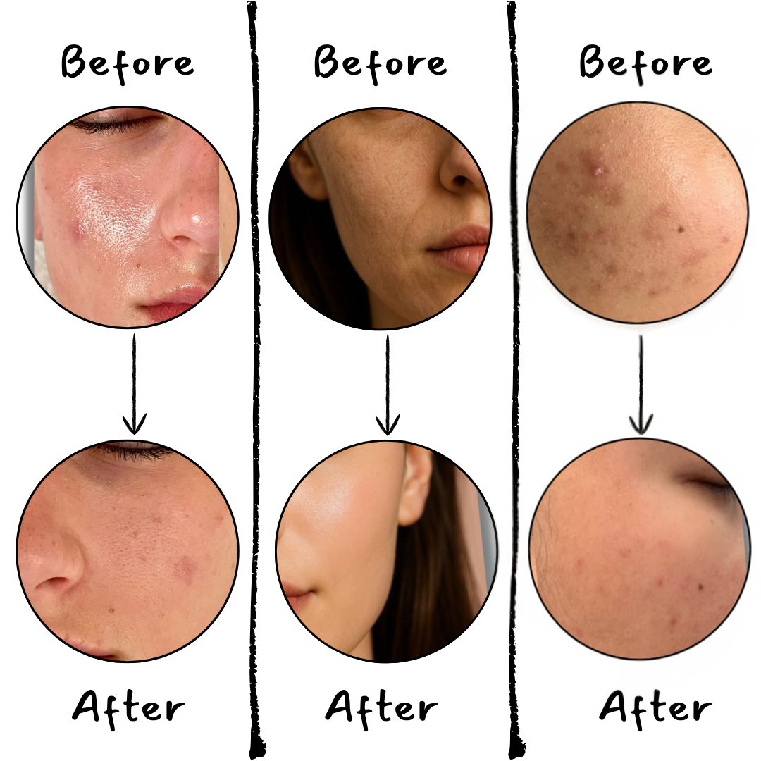 Pure Trio For All Skin + Gift