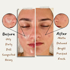 Charcoal Bar For Oily Skin