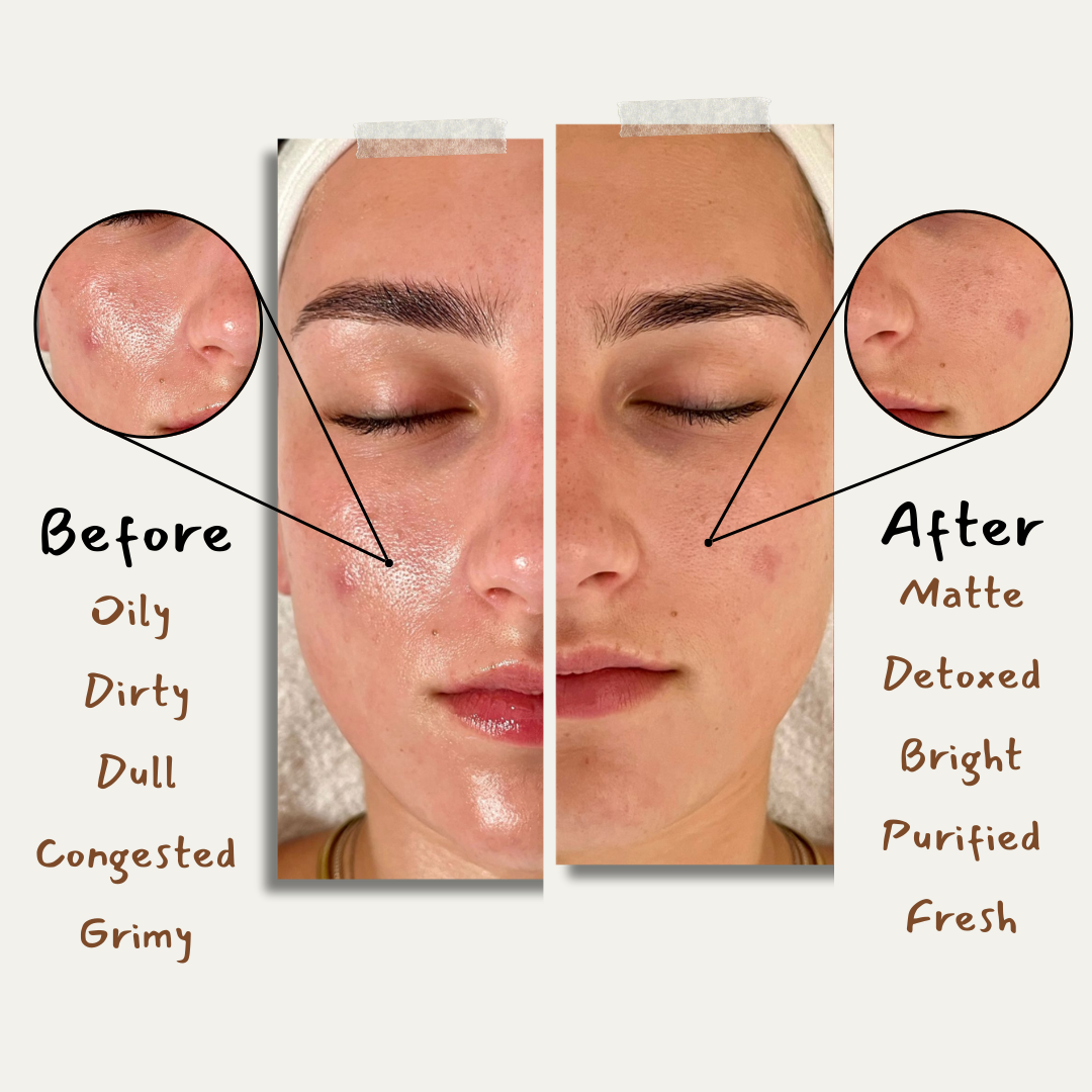 Charcoal Trio For Oily Skin + Gift